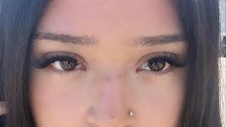 EYEBAG REMOVAL ( 1𝒳 ) ˖ ࣪ ⊹