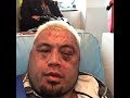 Mark Hunt - Iron Chin Compilation/Highlights