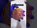 #cultureandsensitivity #clinicalmicrobiology #laboratory #bloodtest #urinetest #amr #antibiotics