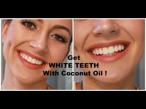 How To WHITEN Your TEETH With Coconut Oil