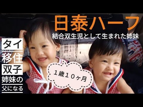 結合双生児 タイ 日タイハーフ結合双生児として生まれた姉妹 もうすぐ２歳の誕生日 Youtube