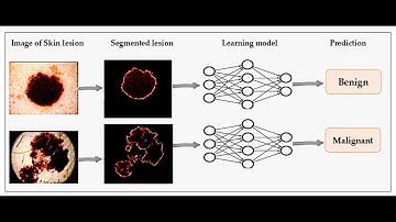 Skin Disease Detection Using Neural Network Python OpenCV Project Source Code