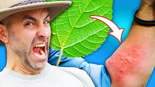 STUNG by a GIANT Stinging Tree!