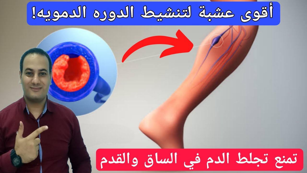 ستندهش أقوى عشبة لتنشيط تعزيز الدورة الدموية في الساق والقدم فورا/عشبة تذيب الجلطات في الساق والقدم