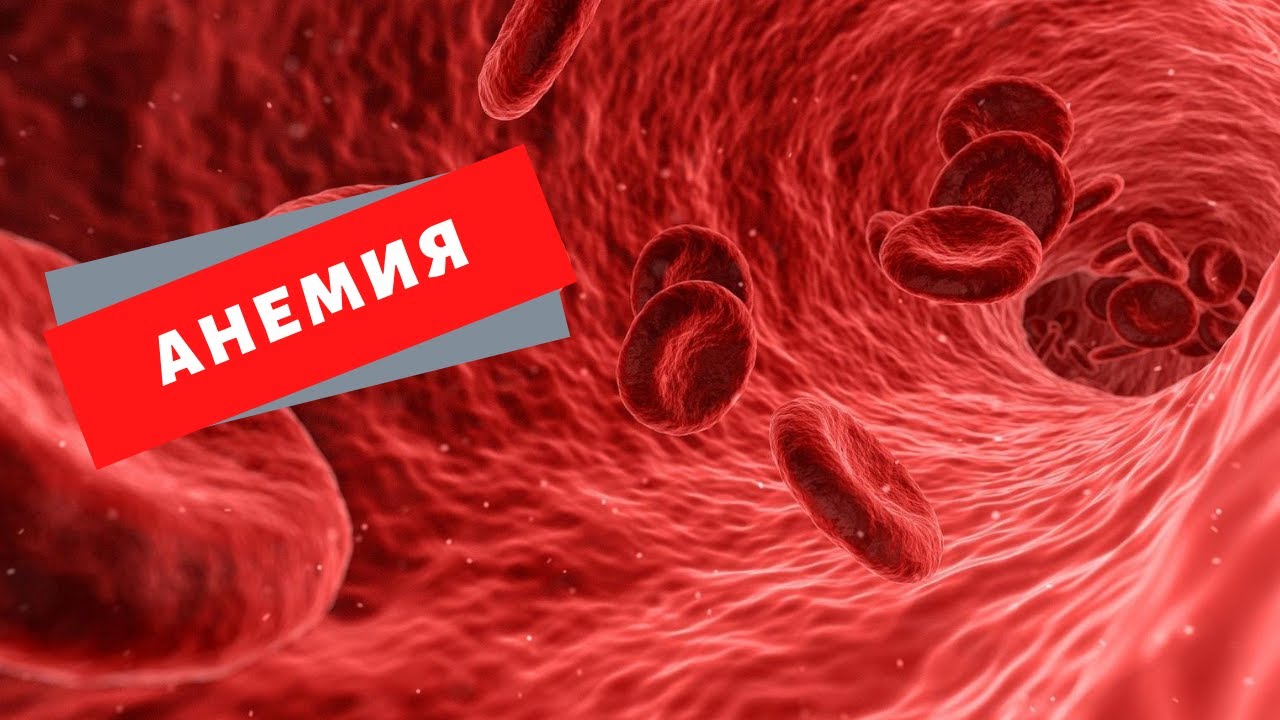 Как вылечить анемию народными средствами? Причины анемии и симптомы ...