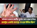‘বর্তমানে হামকে জাতীয় দুর্যোগ বলে ঘোষণা দিয়ে রাষ্ট্রের একটা ব্যবস্থা নেওয়া উচিত ছিল’ | ATN Bangla