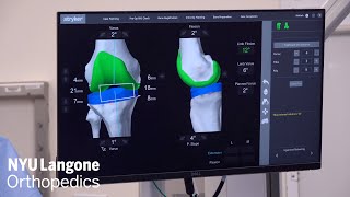 Robotic-assisted Restricted Kinematic Press-fit TKA: Utilizing CPAK Classification