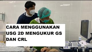HOW TO USE 2D ULTRASOUND TO MEASURE GS AND CRL MEASUREMENTS