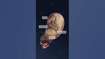 What is central placenta previa and how does it impact pregnancy? Obstetrics explained in 3D