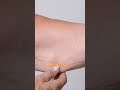 The Limits of Non-Surgical Aesthetic Treatments | Dr Devayani Barve