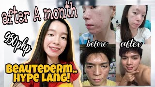 Beautederm review (the truth about this product)
