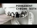 Permanent Chrome Teeth