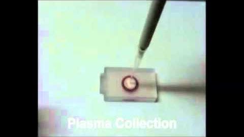 A High-Efficiency Superhydrophobic Plasma Separator