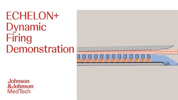 ECHELON+ Dynamic Firing Video | J&J MedTech
