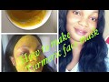 DIY Turmeric Face Mask!Get Clear,Bright &amp; Acne Free Skin