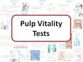 Pulp Vitality Tests: Laser Doppler Flowmetry, Pulse Oximetry, Percussion (Tooth Slooth), Test Cavity