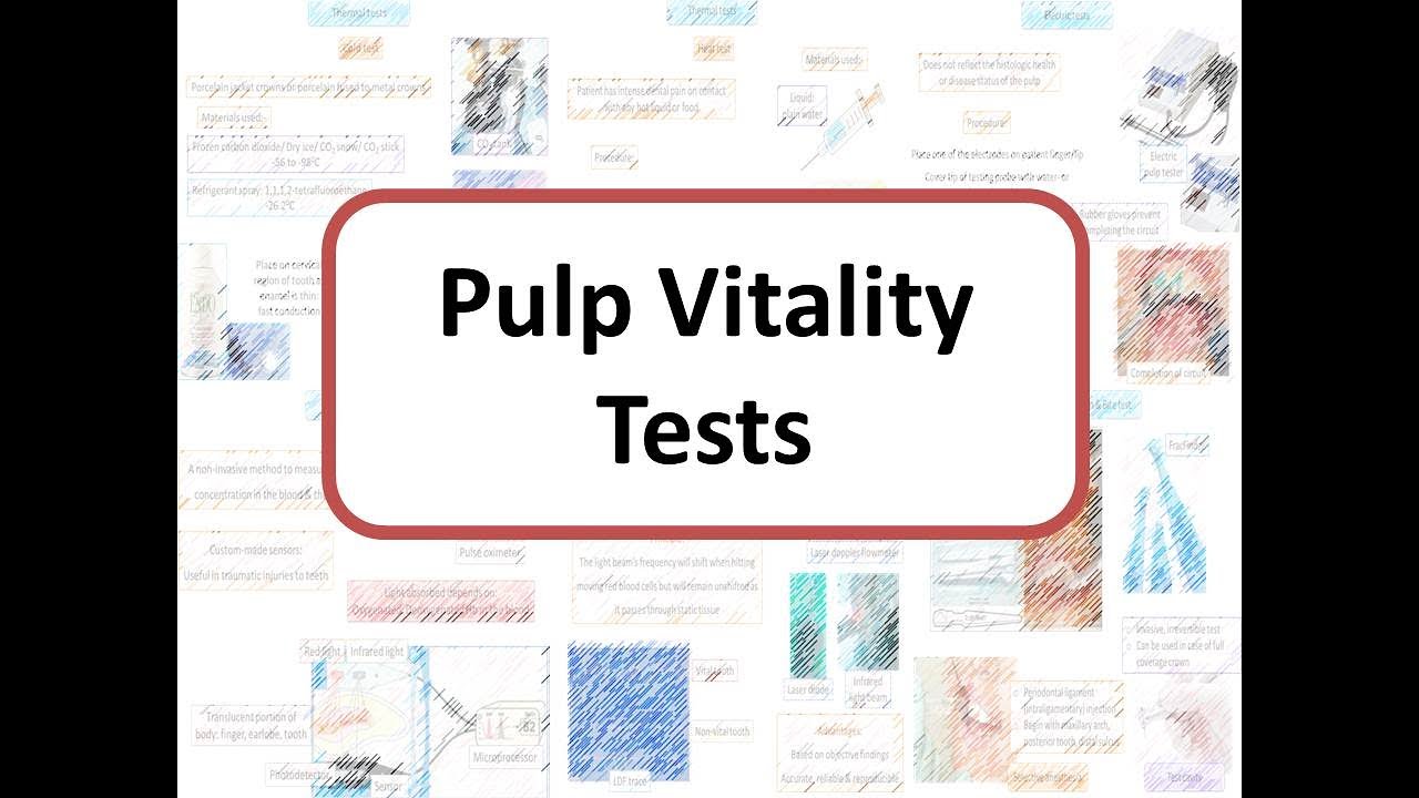 Vitality Test For Tooth at Jose Bass blog