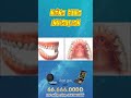 3D NIỀNG RĂNG INVSALIGN Nha Khoa Quốc Tế Athena 