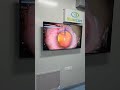 -23D GLASSES to crystal clear vision #visioncaremeerut