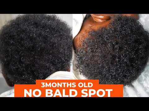 HOW TO PREVENT BALD SPOT ON BABY