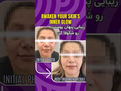 🌟 Awaken Your