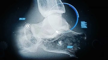 Teledyne DALSA: Bringing Advanced X-Ray Imaging to Life