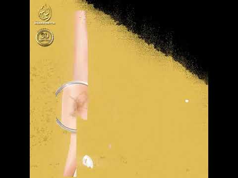 الدوالى علاجها سهل بدون ألم أو جراحة مع أ د أسامة حتة 