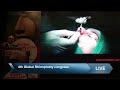 Jaipurdoorbeen hospital live stream