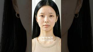 Korean skincare routine for acne.💧 #acne #skincare #pore