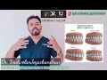        how to straighten your teeth in chennai and salem