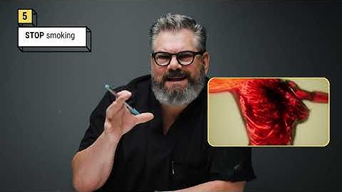 How to Avoid Capsular Contracture