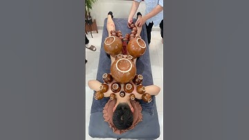 Thumbnail of [ASMR] Cupping Therapy with super Cups #asmr #cuppingtherapy #massage #youtubeshorts