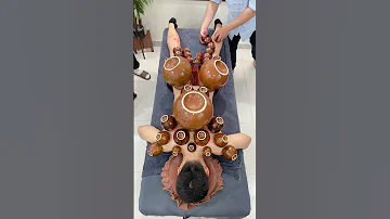 ASMR Cupping Therapy With Super Cups Asmr Cuppingtherapy Massage Youtubeshorts 