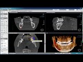 Обзор программы Ondemand3d Dental