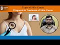 How to check for Skin Cancer ? | Skin Cancer Prevention - Dr. Rajdeep Mysore | Doctors&#39; Circle