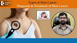 How to check for Skin Cancer ? | Skin Cancer Prevention  Dr. Rajdeep Mysore | Doctors' Circle