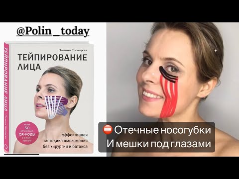 ⛔️ Отечные носогубки и мешки под глазами! #тейпированиелица #тейпированиетела #тейпирование