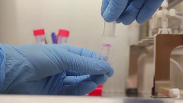 How to introduce 3D scaffolds in the EBERS P3D perfusion chambers