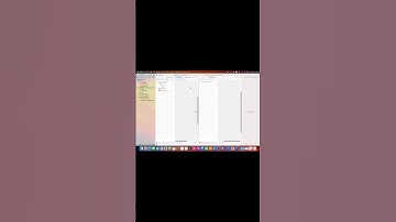 UIButton Guide for iOS Devs
