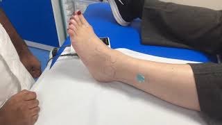 How to check for the peroneal artery pulse with a Doppler