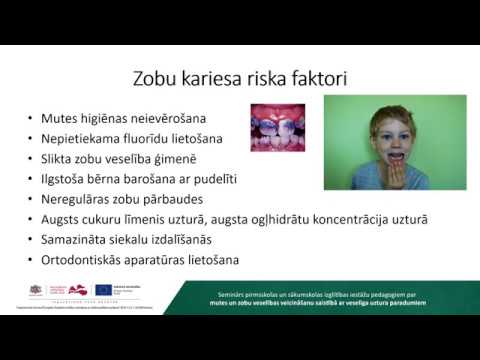 Video: Vai izšķīdušos gudrības zobus ir vieglāk noņemt?