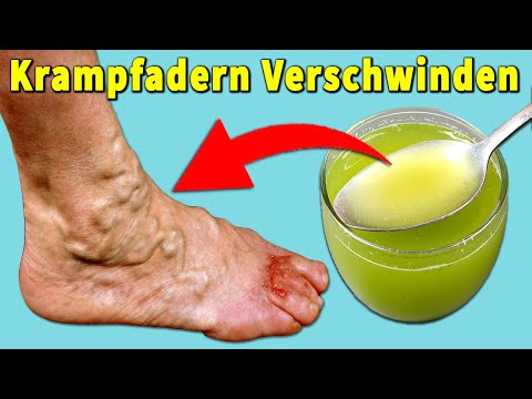 Video: So Erhalten Sie Kupferhydroxid