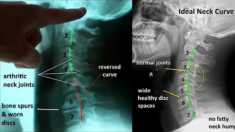 X-Ray or MRI? Actual patient images (Video 3 of 3)