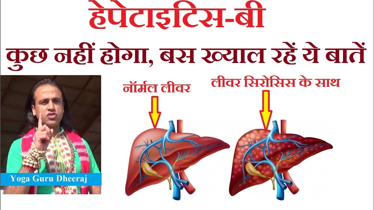 हेपेटाइटिस बी : कुछ नहीं होगा अगर ख्याल रहें ये बात | Yoga for Hepatitis B Important Facts