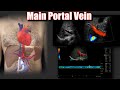 Portal vein doppler protocol