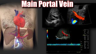 Portal Vein Doppler Protocol