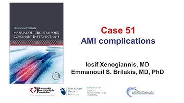 Case 51: PCI Manual - MI complications