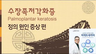 수장족저각화증 - 원인 증상 편