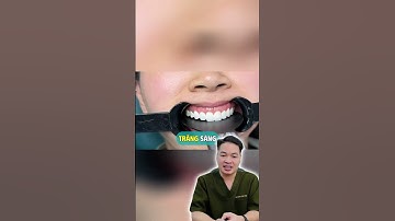 Nụ cười nay đã có “bản quyền” #drThu #BsThu #Dansuthammy #Veneer