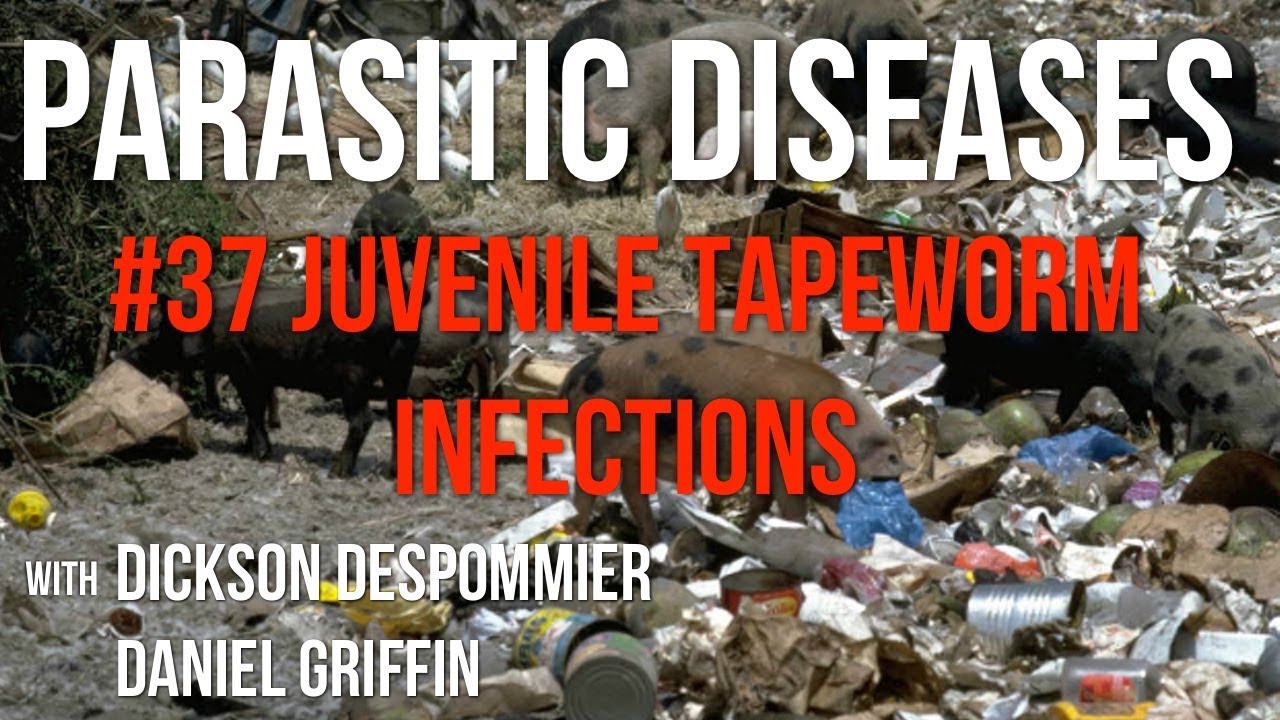 Parasitic Diseases Lectures 37 Juvenile Tapeworm Infections YouTube